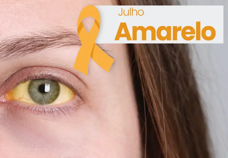 Julho Amarelo - mês de prevenção às Hepatites virais